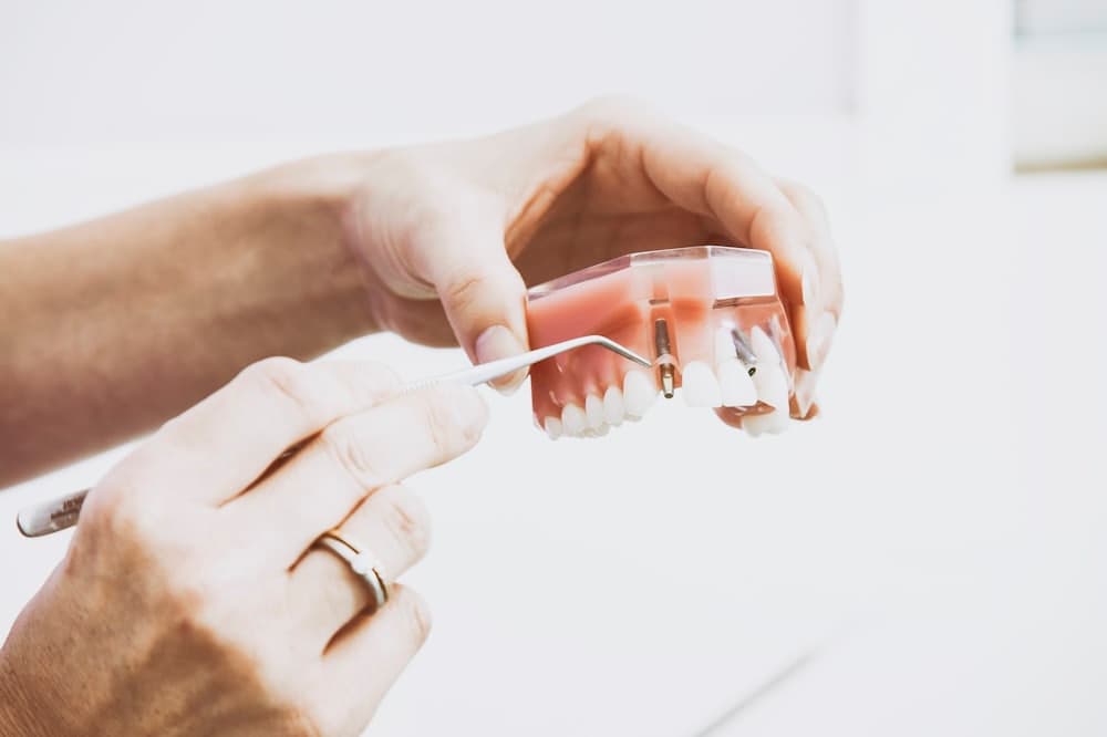 Prótese Dentária